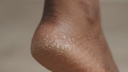 PediLisse - Râpe Électrique pour Pieds Sans Fil rechargeable– Dites Adieu aux Talons Rugueux et Retrouvez des Pieds Doux et Soignés !